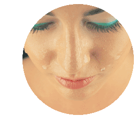 botox botox