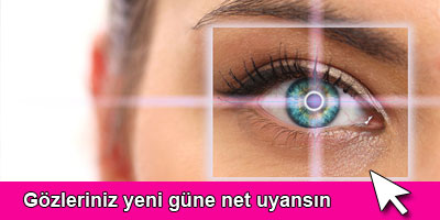 Kaslar Lens Mi 560914 Uludag Sozluk Galeri